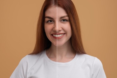 Woman with freckles and clear skin on dark beige background, collage