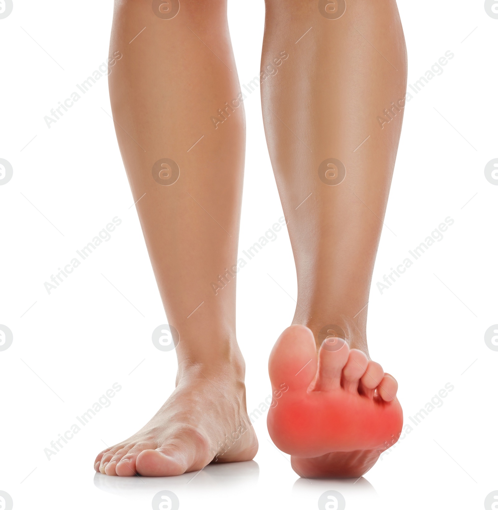 Image of Woman suffering from foot pain on white background, closeup