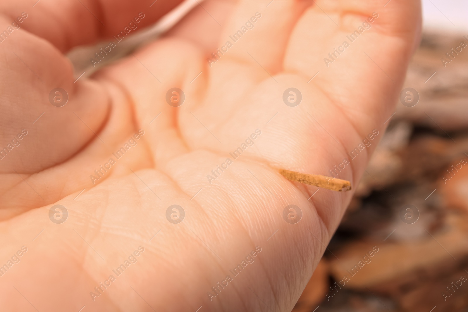 Photo of Woman with splinter in her hand on blurred background, closeup