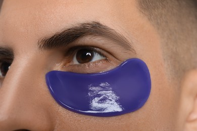 Photo of Man with blue under eye patch, closeup