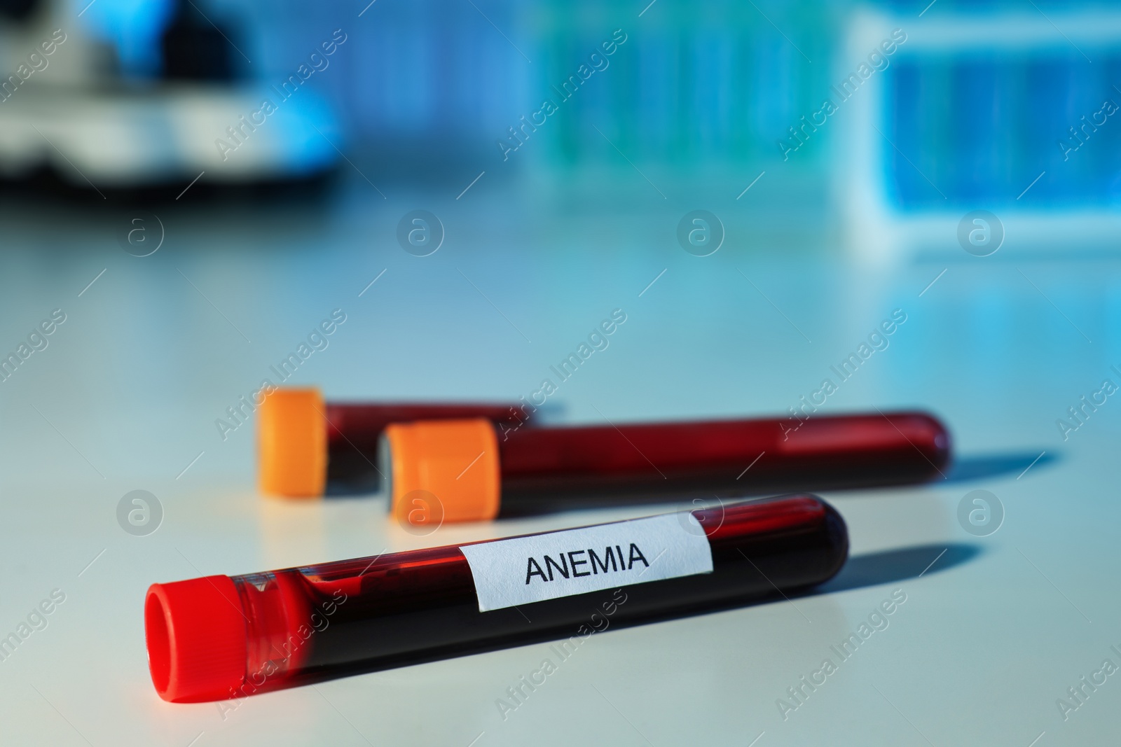 Photo of Test tubes with blood samples and label Anemia on white table against blurred background, closeup. Space for text