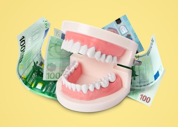 Image of Model of oral cavity with teeth and euro banknotes on yellow background. Concept of expensive dental procedures