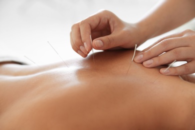 Photo of Young woman undergoing acupuncture treatment in salon, closeup