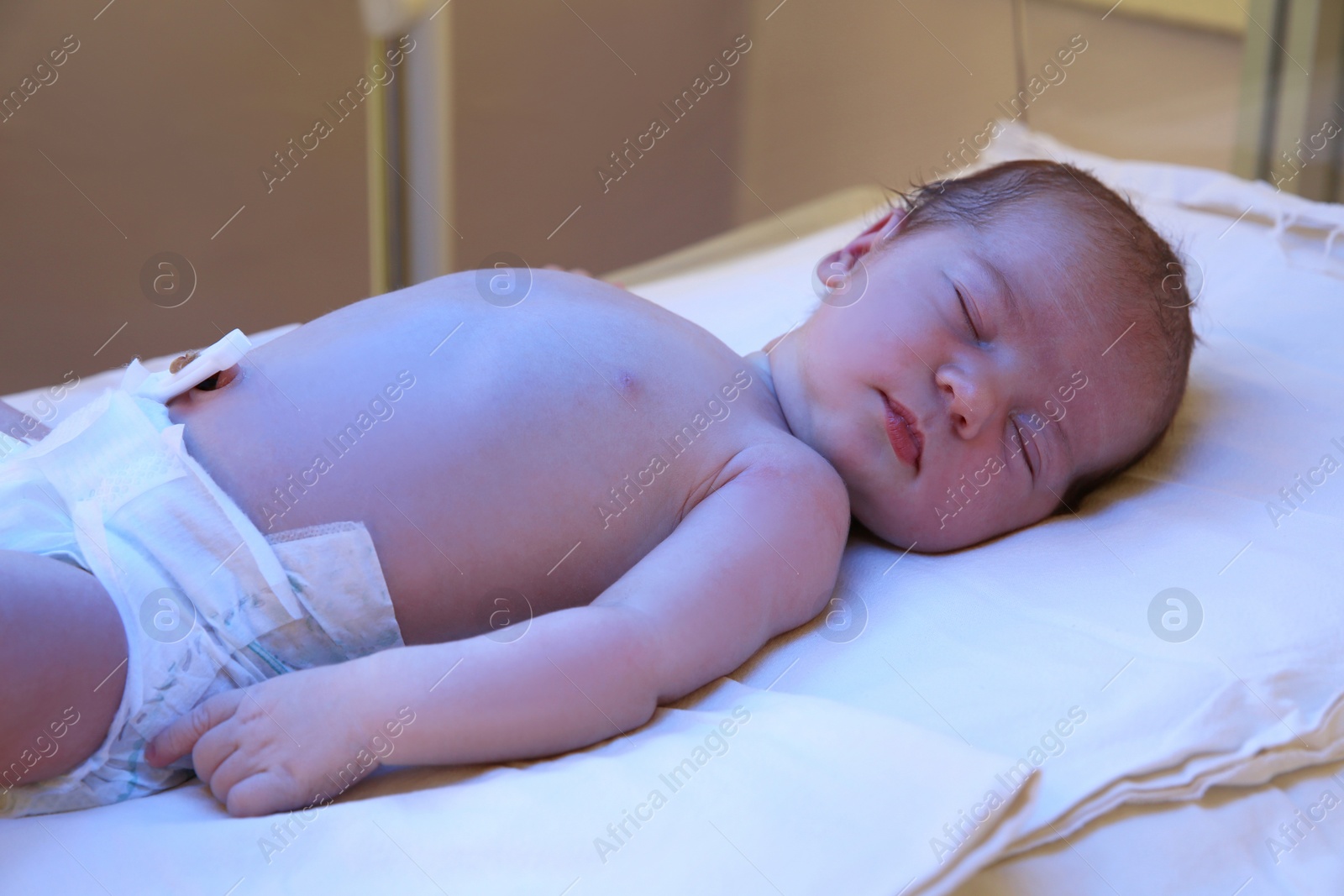 Photo of Newborn child under ultraviolet light in hospital