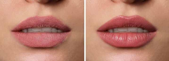 Image of Collage with photos of woman with dry and moisturized lips, closeup. Banner design