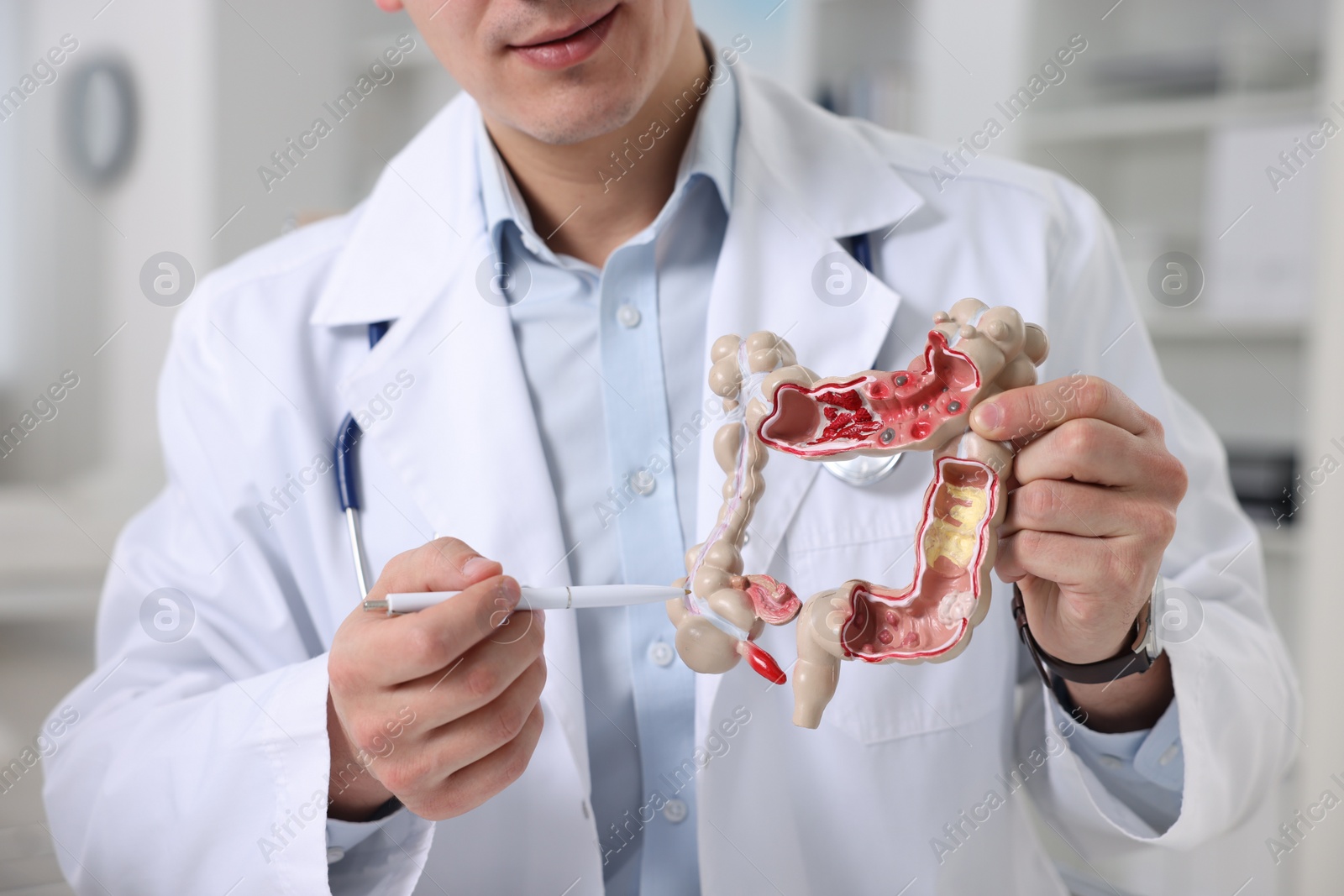 Photo of Gastroenterologist showing anatomical model of large intestine in clinic, closeup