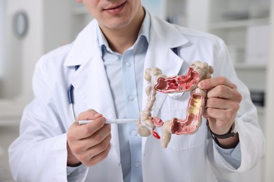 Photo of Gastroenterologist showing anatomical model of large intestine in clinic, closeup