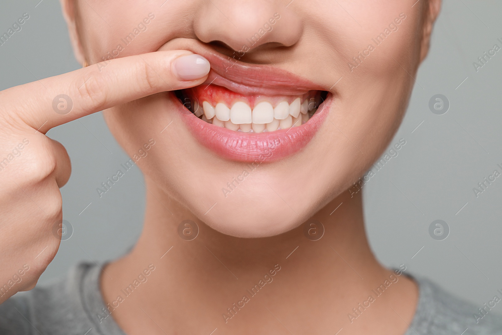 Image of Woman showing inflamed gum on grey background, closeup