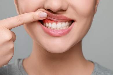 Woman showing inflamed gum on grey background, closeup