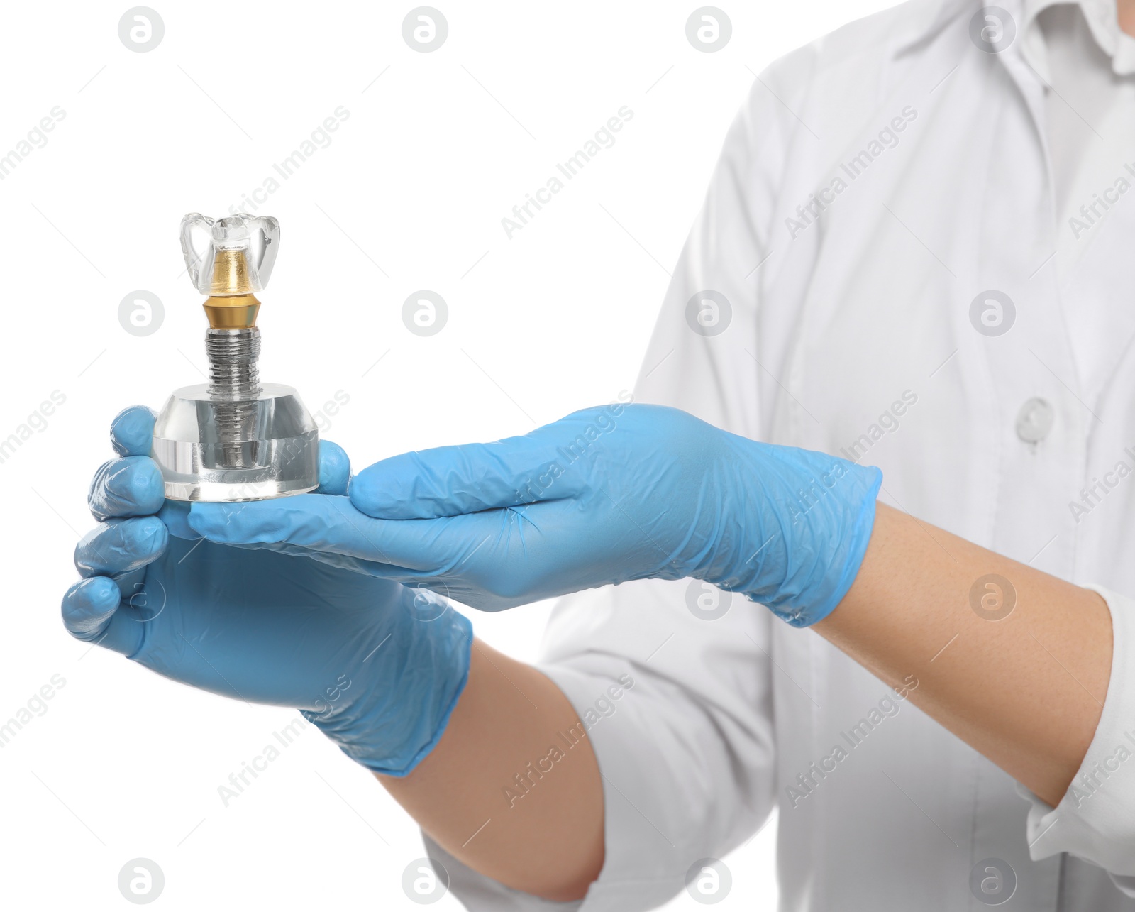 Photo of Dentist holding educational model of dental implant on white background, closeup