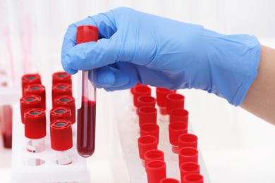 Scientist working with blood samples in test tubes at table