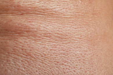 Photo of Closeup view of human skin as background