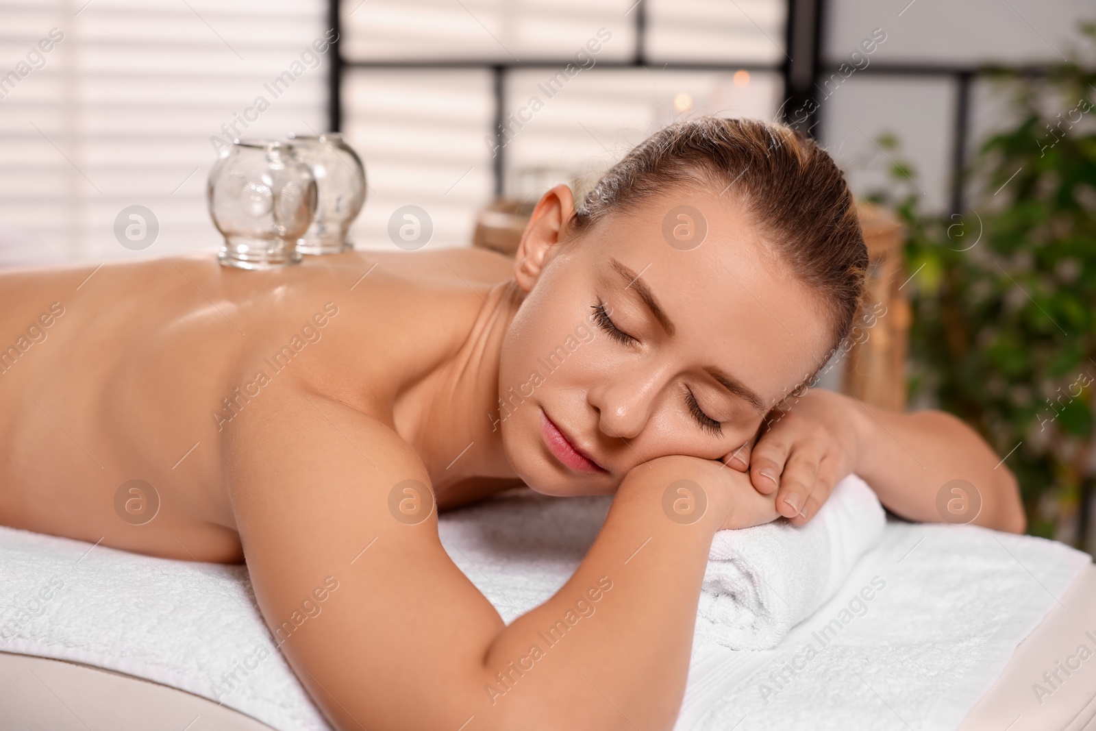 Photo of Cupping therapy. Woman with glass cups on massage couch in spa salon