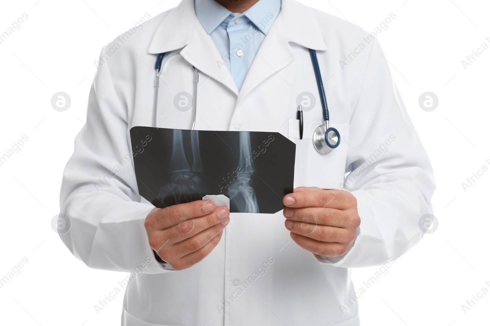 Photo of Orthopedist holding X-ray picture on white background, closeup