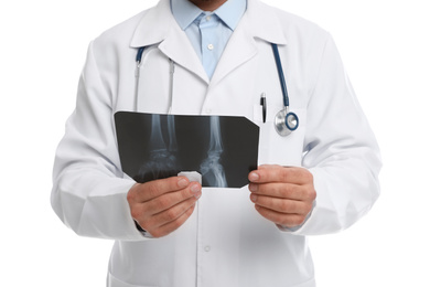 Photo of Orthopedist holding X-ray picture on white background, closeup