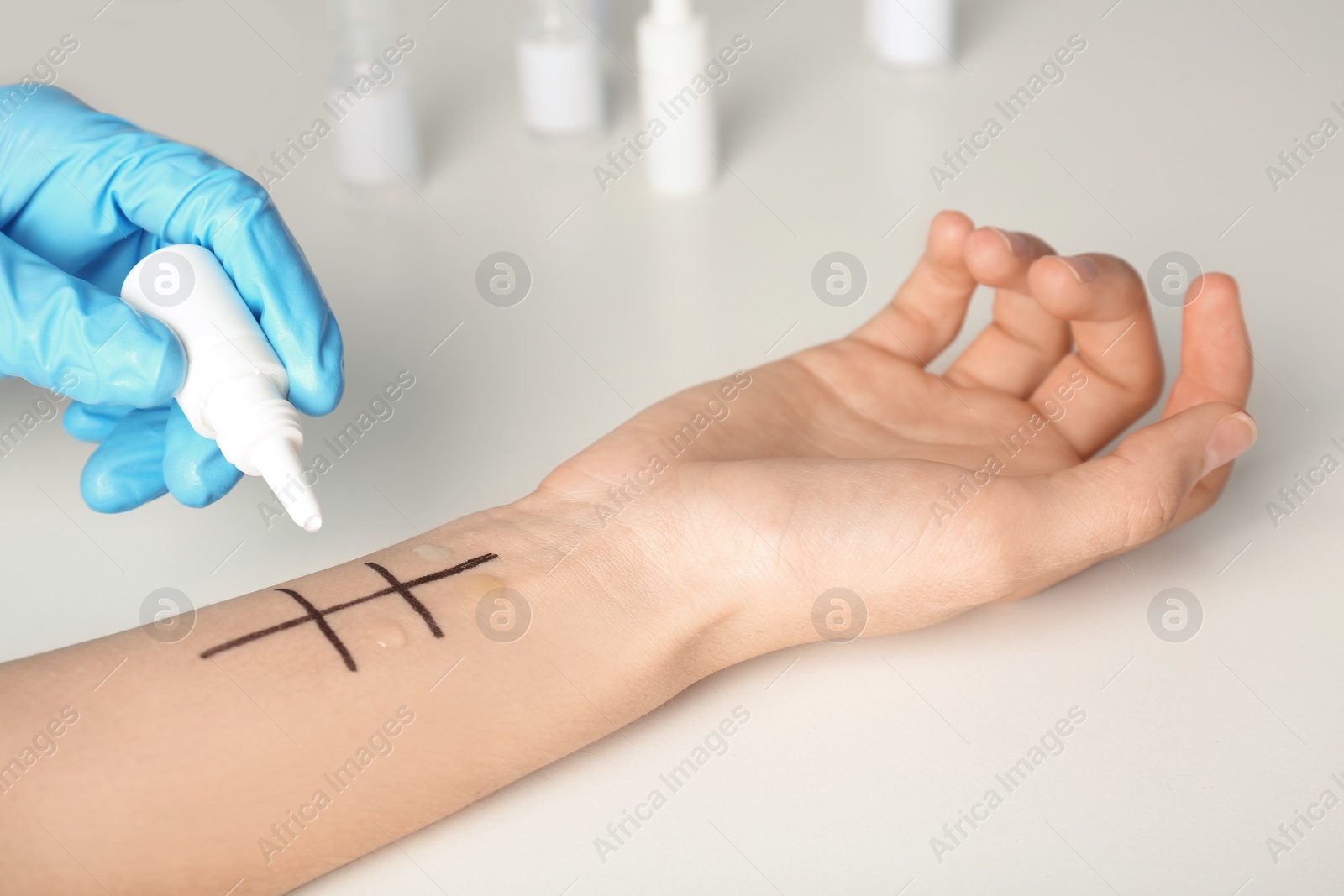Photo of Doctor making allergy test at table, closeup