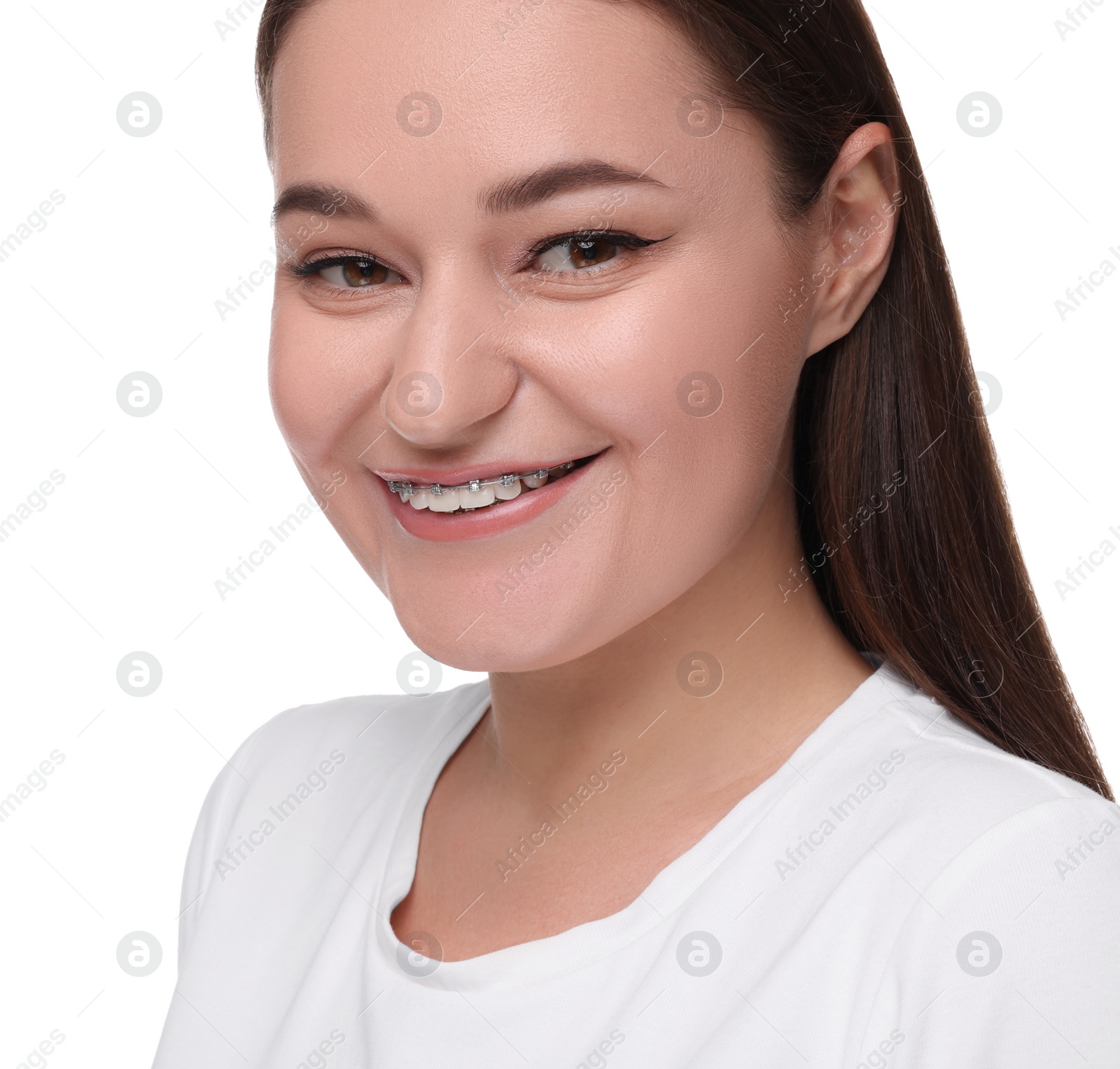 Photo of Smiling woman with dental braces on white background. Space for text