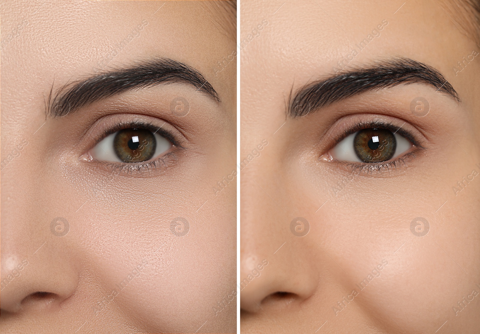 Image of Collage with photos of woman having dry skin problem before and after moisturizing, closeup