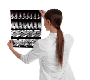 Photo of Orthopedist holding X-ray picture on white background