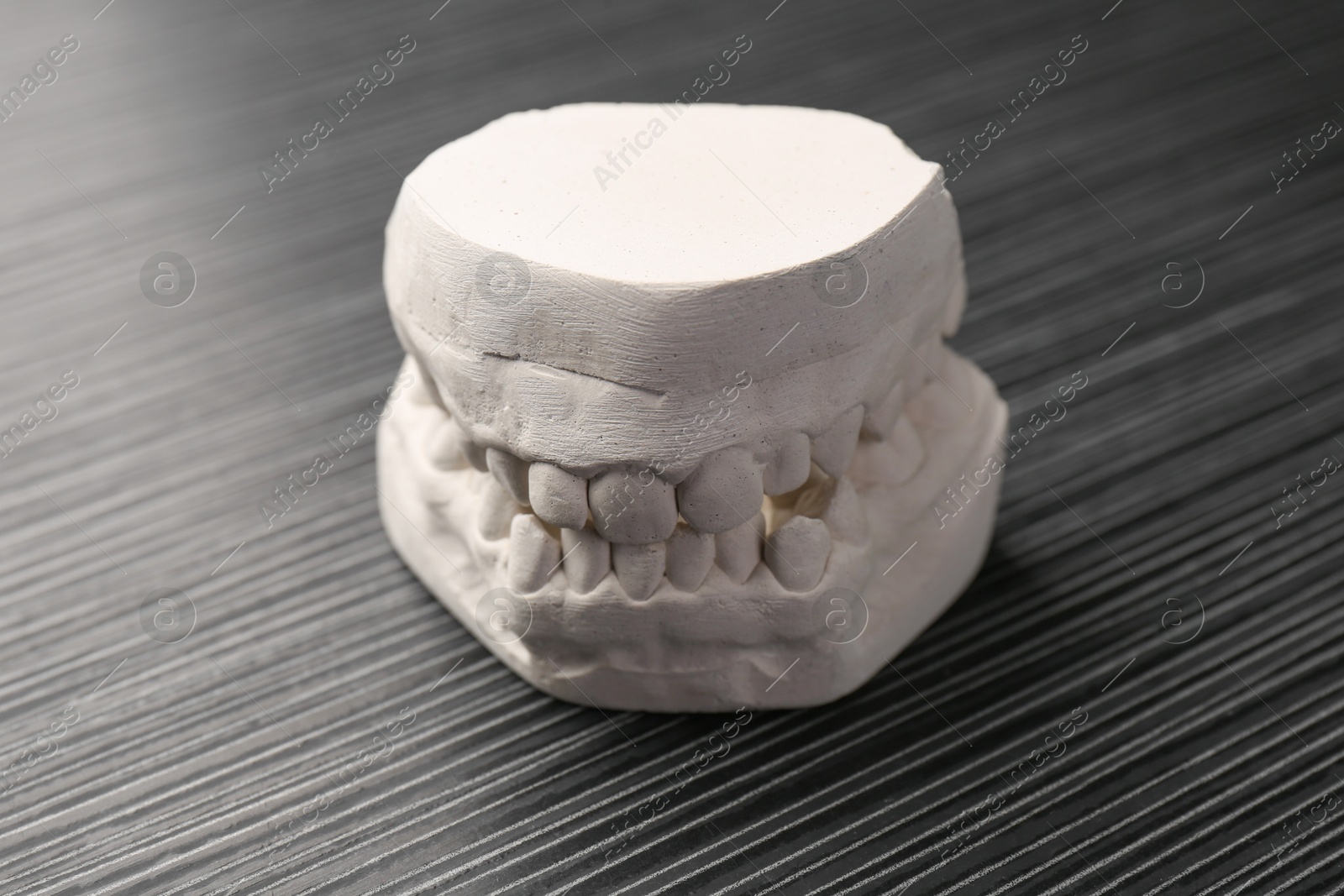 Photo of Dental model with gums on grey wooden table. Cast of teeth