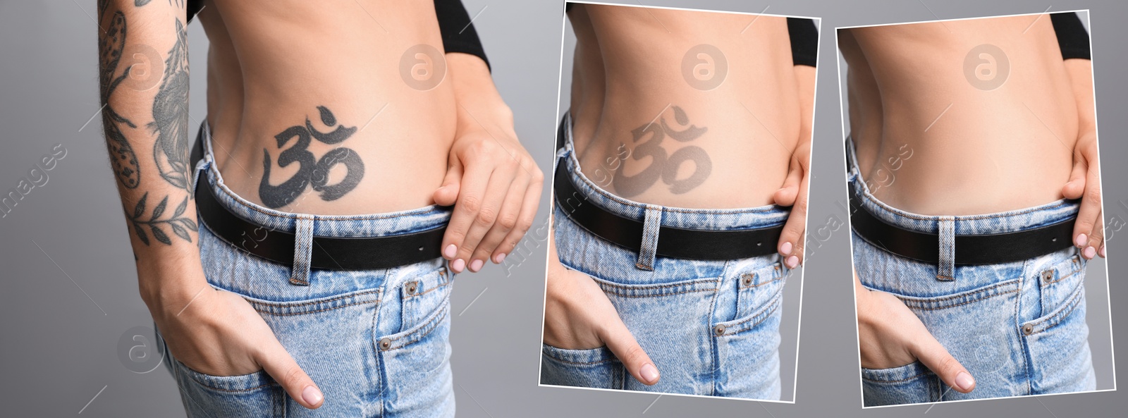 Image of Woman before and after laser tattoo removal procedures on grey background, closeup. Collage with photos, banner design