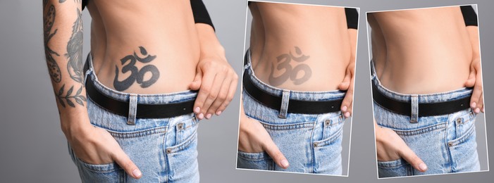 Image of Woman before and after laser tattoo removal procedures on grey background, closeup. Collage with photos, banner design