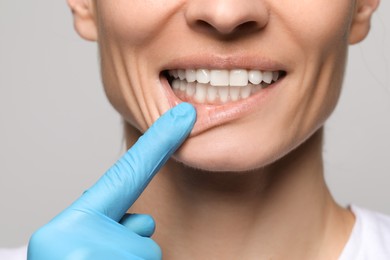 Photo of Doctor examining woman's gums on light background, closeup