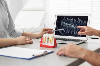 Photo of Doctor showing patient X-ray picture and educational model of dental implant in clinic, closeup