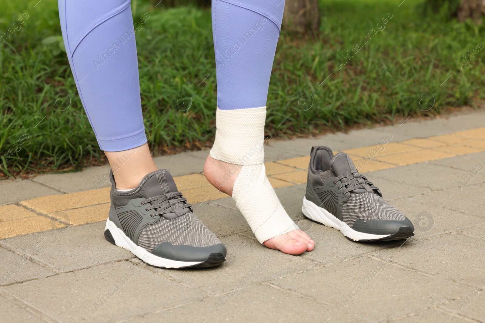 Photo of Woman with foot wrapped in medical bandage on outdoors, closeup