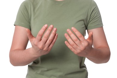 Photo of Woman on white background, closeup of hands. Arthritis symptom