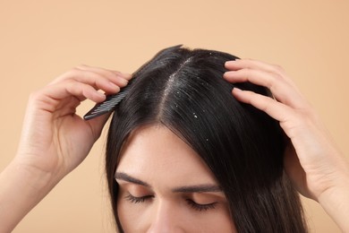 Photo of Woman with comb examining her hair and scalp on beige background, closeup. Dandruff problem