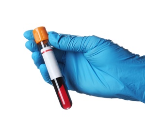 Laboratory worker holding test tube with blood sample for analysis isolated on white, closeup