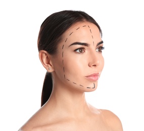 Young woman with marks on face for cosmetic surgery operation against white background