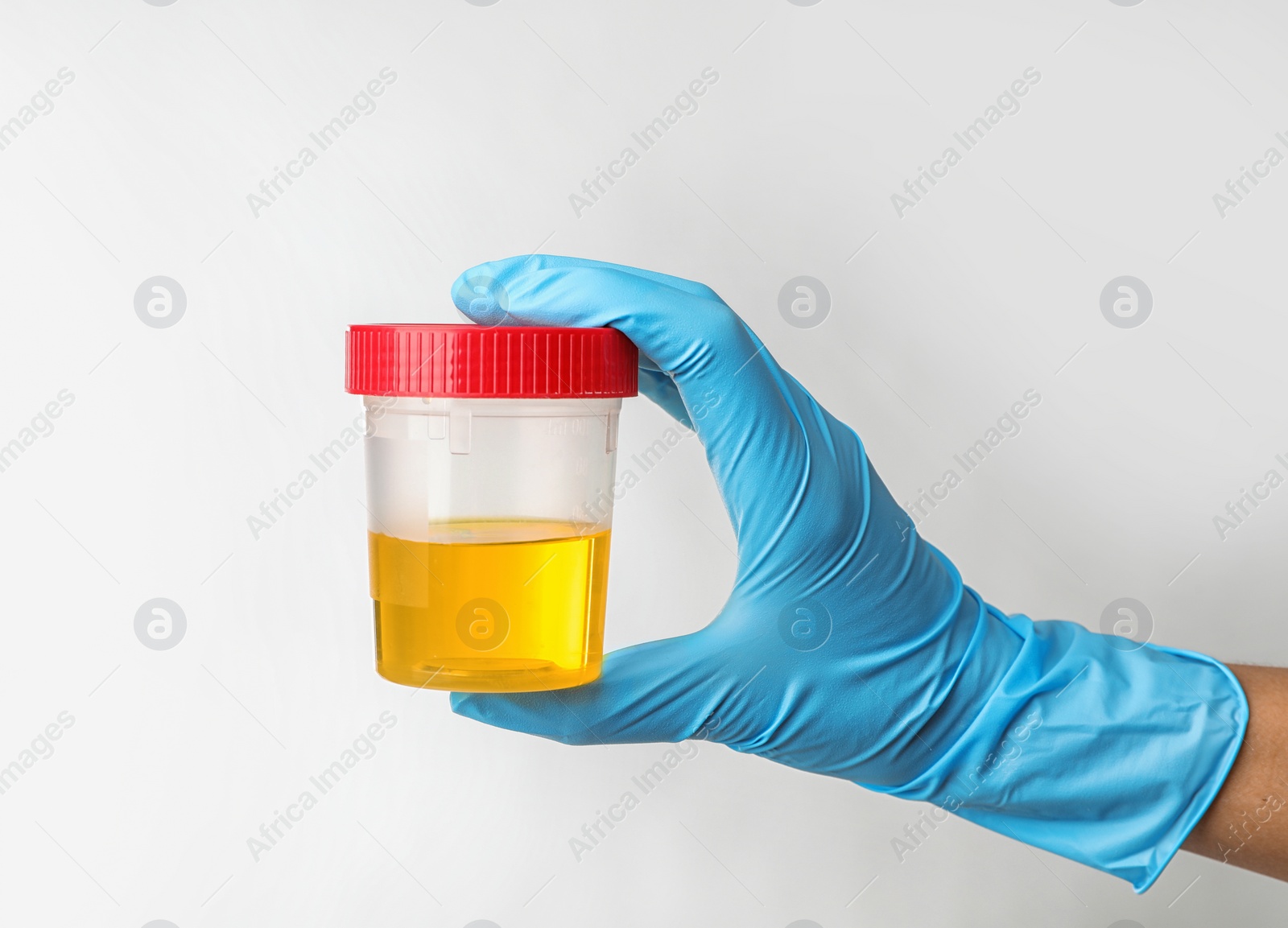 Photo of Laboratory worker holding jar with urine sample on light background. Urology concept