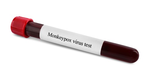Monkeypox virus test. Sample tube with blood isolated on white