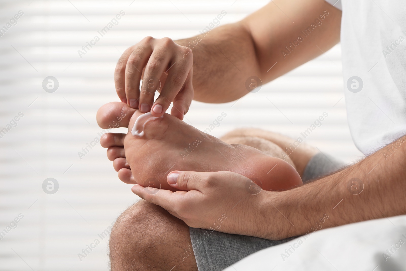 Photo of Man with dry skin applying cream onto his foot on light background, closeup