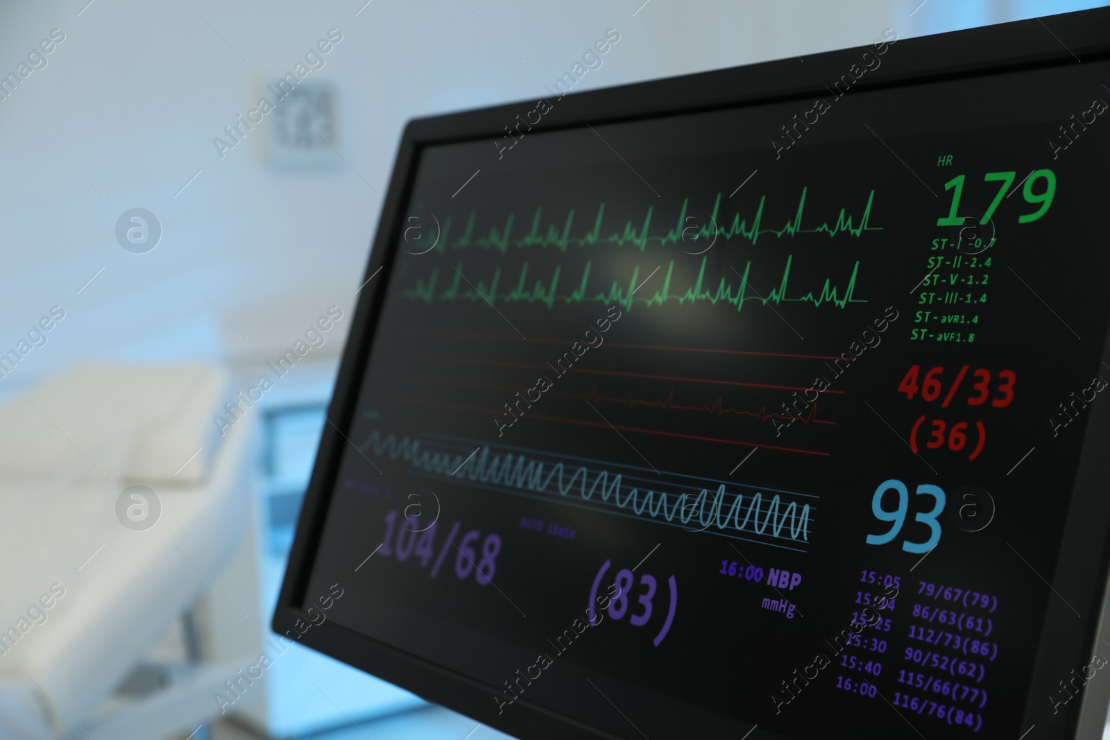 Photo of Monitor with cardiogram in hospital, closeup. Space for text