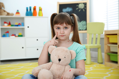 Photo of Little girl with chickenpox holding teddy bear at home