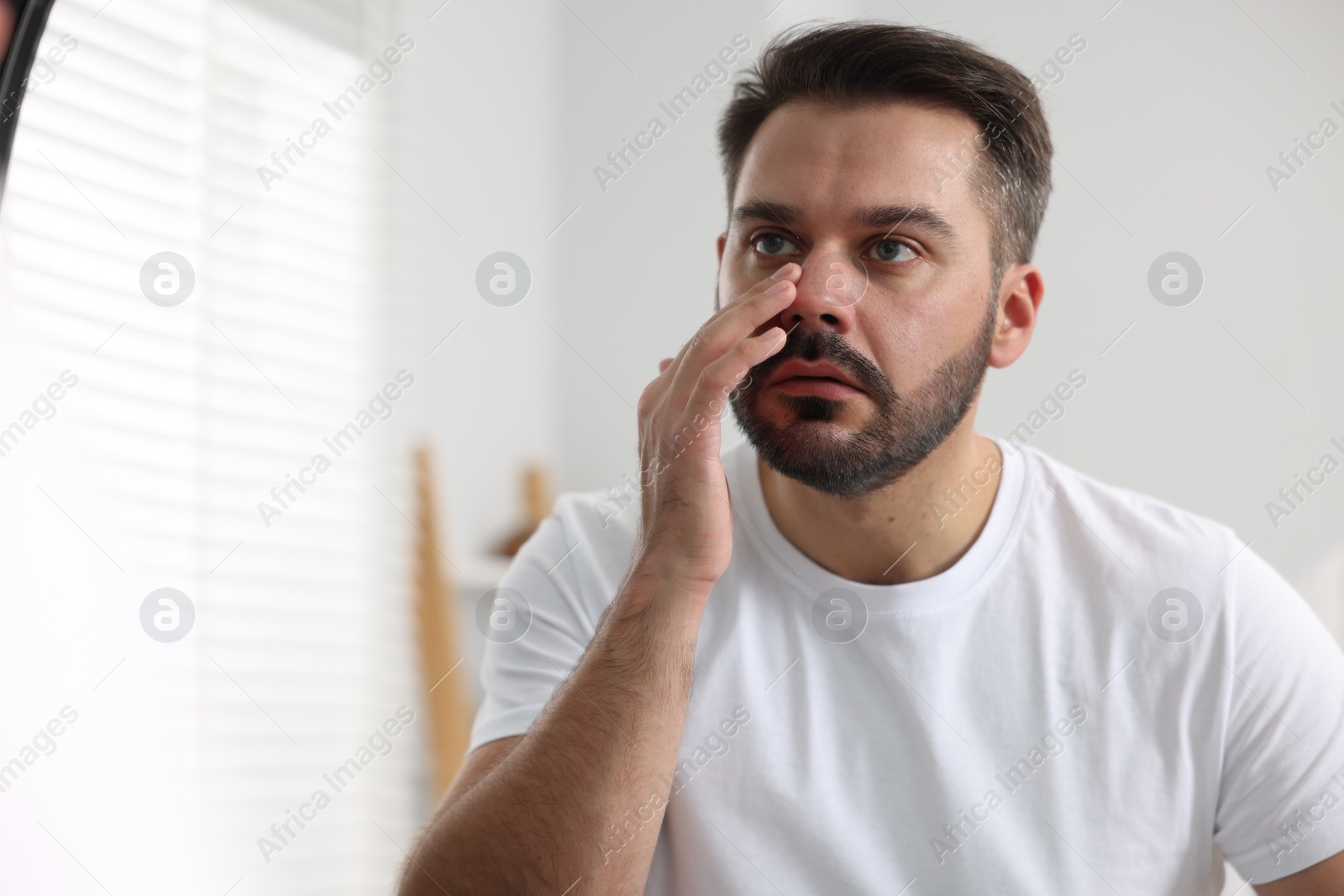 Photo of Confused man with skin problem looking at mirror indoors, space for text