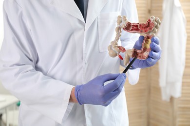 Doctor showing model of large intestine indoors, closeup