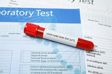 Liver Function Test. Tube with blood sample on forms, closeup