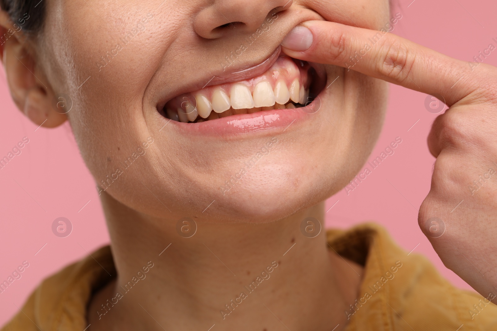 Photo of Woman showing her clean teeth on pink background, closeup