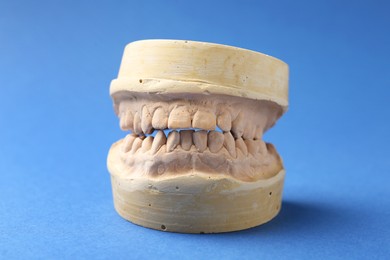 Photo of Dental model with gums on blue background. Cast of teeth