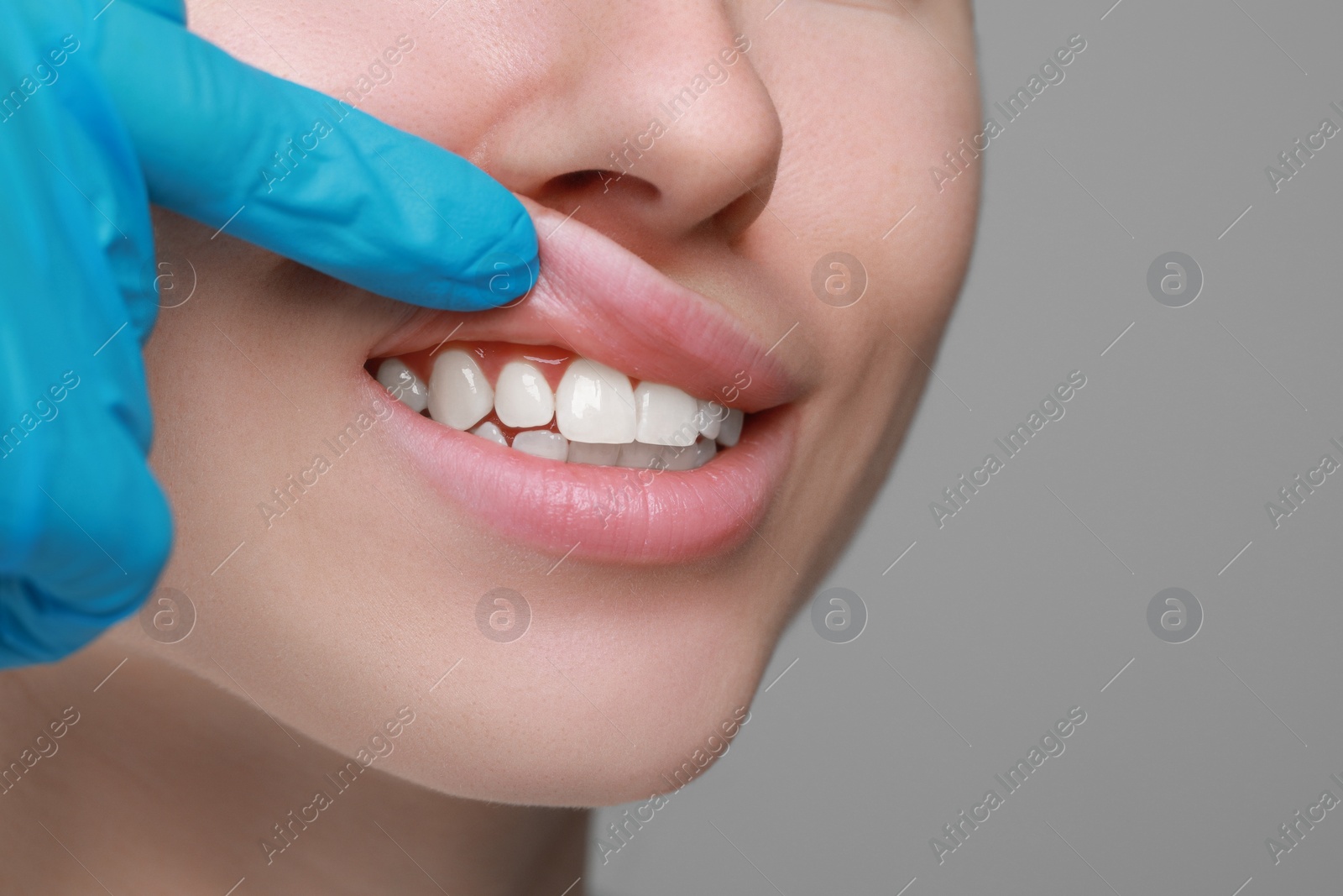 Photo of Doctor examining woman's gums on grey background, closeup. Space for text