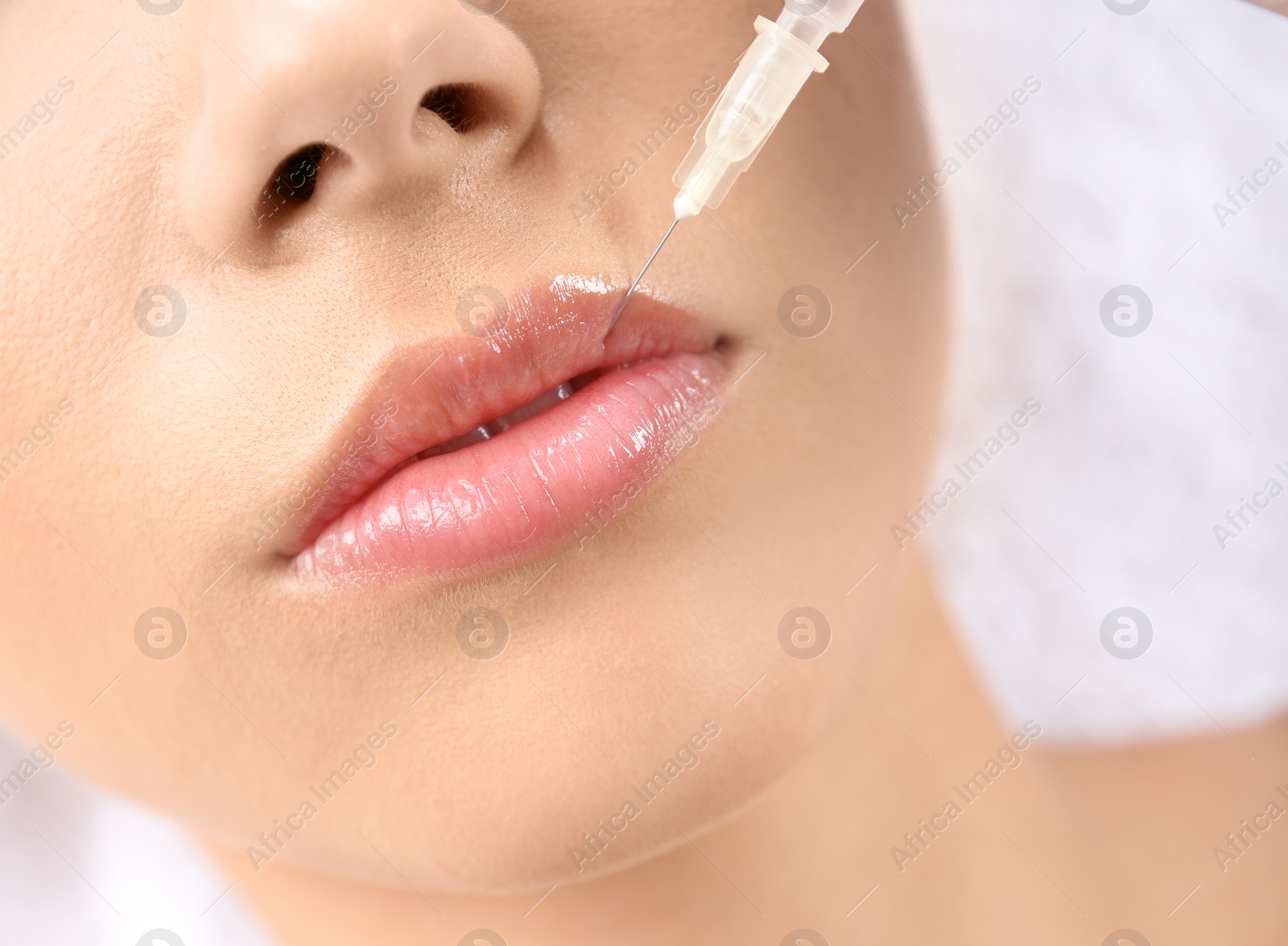 Photo of Young woman getting lip injection in beautician salon, closeup