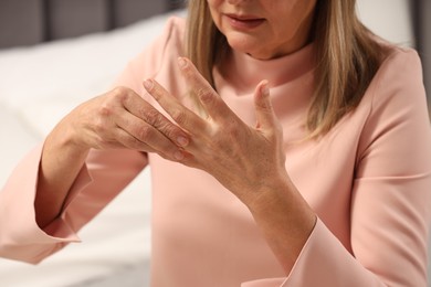 Photo of Mature woman suffering from pain in hand indoors. Rheumatism symptom