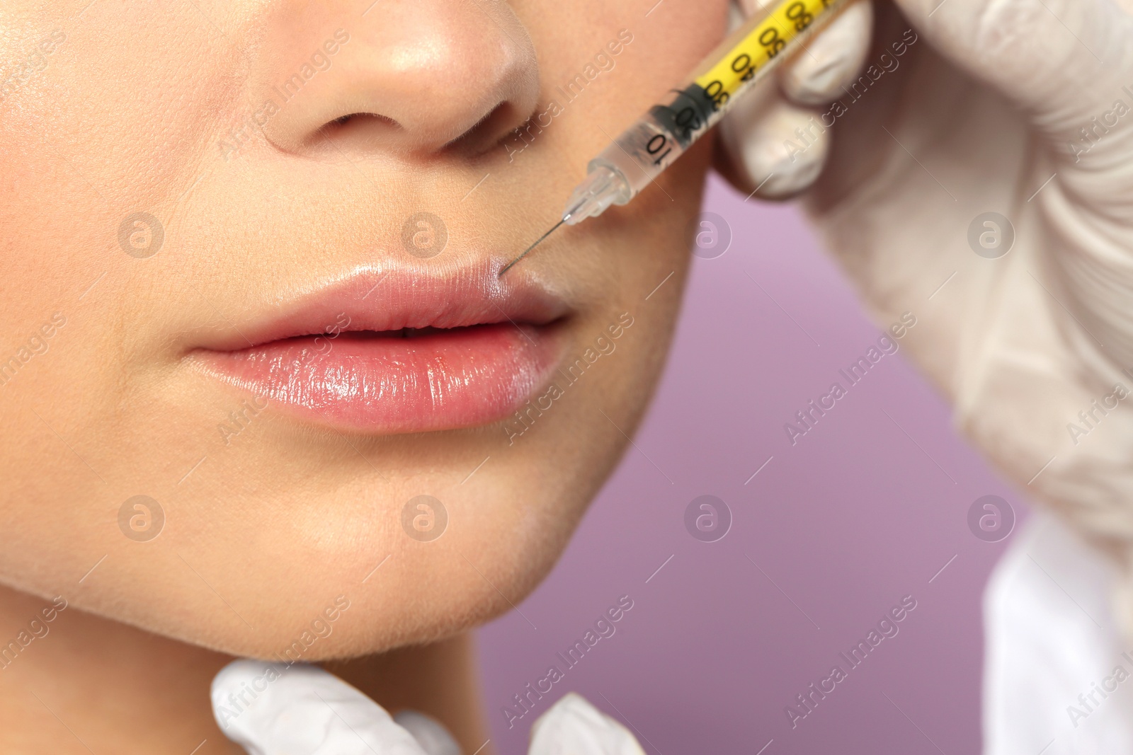 Photo of Young woman getting lips injection on color background, closeup. Cosmetic surgery