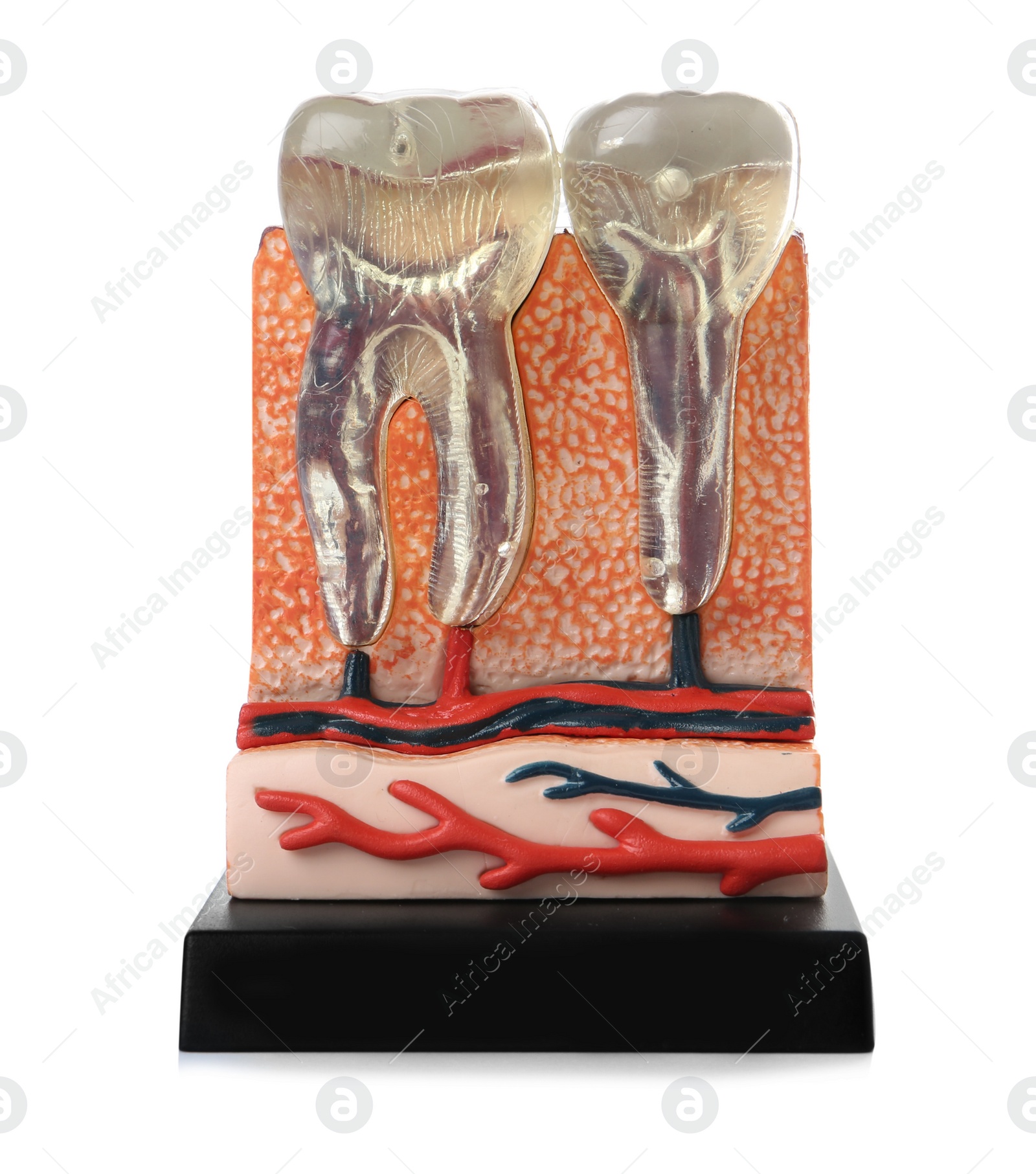 Photo of Educational model of jaw section with teeth on color background