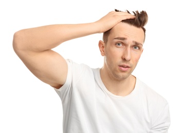 Photo of Young man with hair loss problem on white background