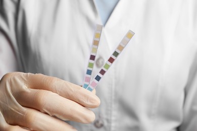 Photo of Doctor holding urine test strips, closeup view